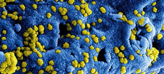 Eerste reactie gemeente Apeldoorn over de Notitie Gevolgen Coronavirus voor de sportverenigingen in de gemeente Apeldoorn